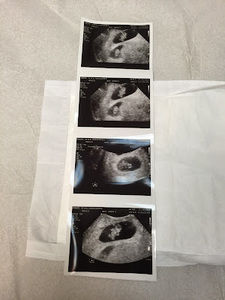 Meet your Posher, Melvin